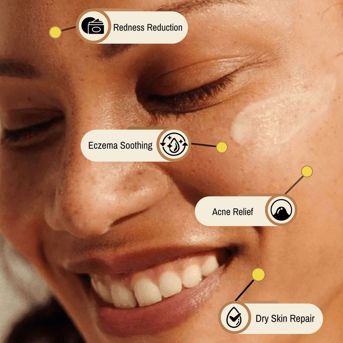 An infographic showcasing the skin benefits of Rzn-A-Bull Tallow Balm on a smiling woman’s face. The image highlights four key benefits with callout labels: Acne Relief, Eczema Soothing, Dry Skin Repair, and Redness Reduction. Each label is connected to specific areas of the face where the balm provides nourishment and healing. The design features soft, natural lighting and a smooth application of the balm on the cheek.